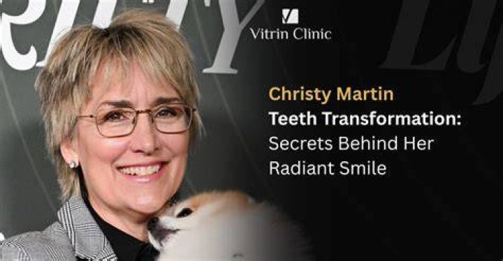 Christy Mack Temporary Teeth