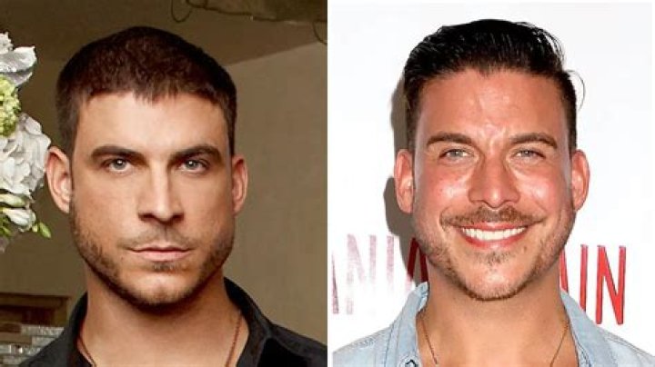 jax taylor nose job