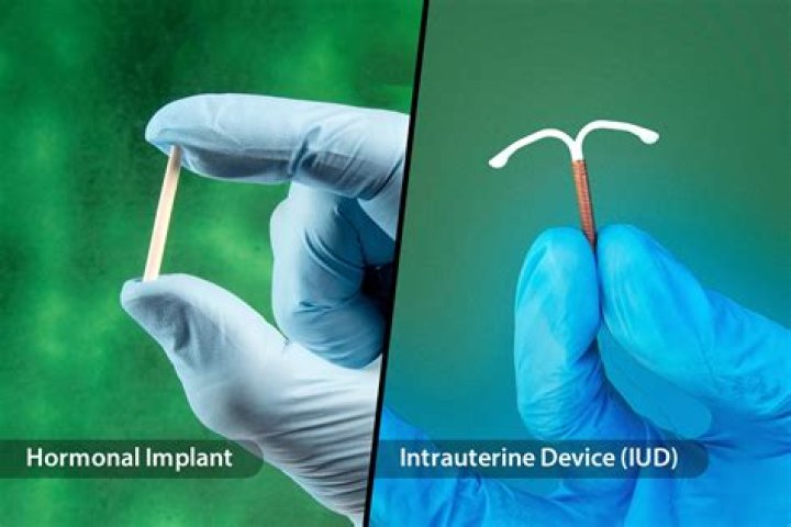 Jessica simpson iud birth control