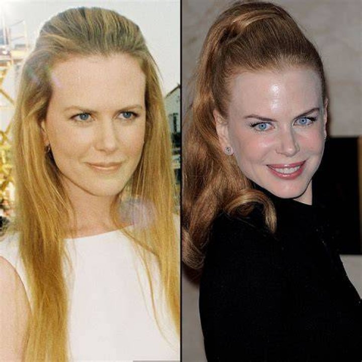 Nicole Kidman